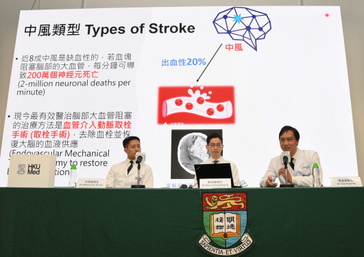(From right) Dr Chan Koon-ho, Dr Kevin Cheng King-fai and Dr Edward Chu Yin-lun announce the clinical outcomes of their study. Extending the stroke treatment golden period from six hours to 24 hours has shown significant benefits for a larger number of patients.
 